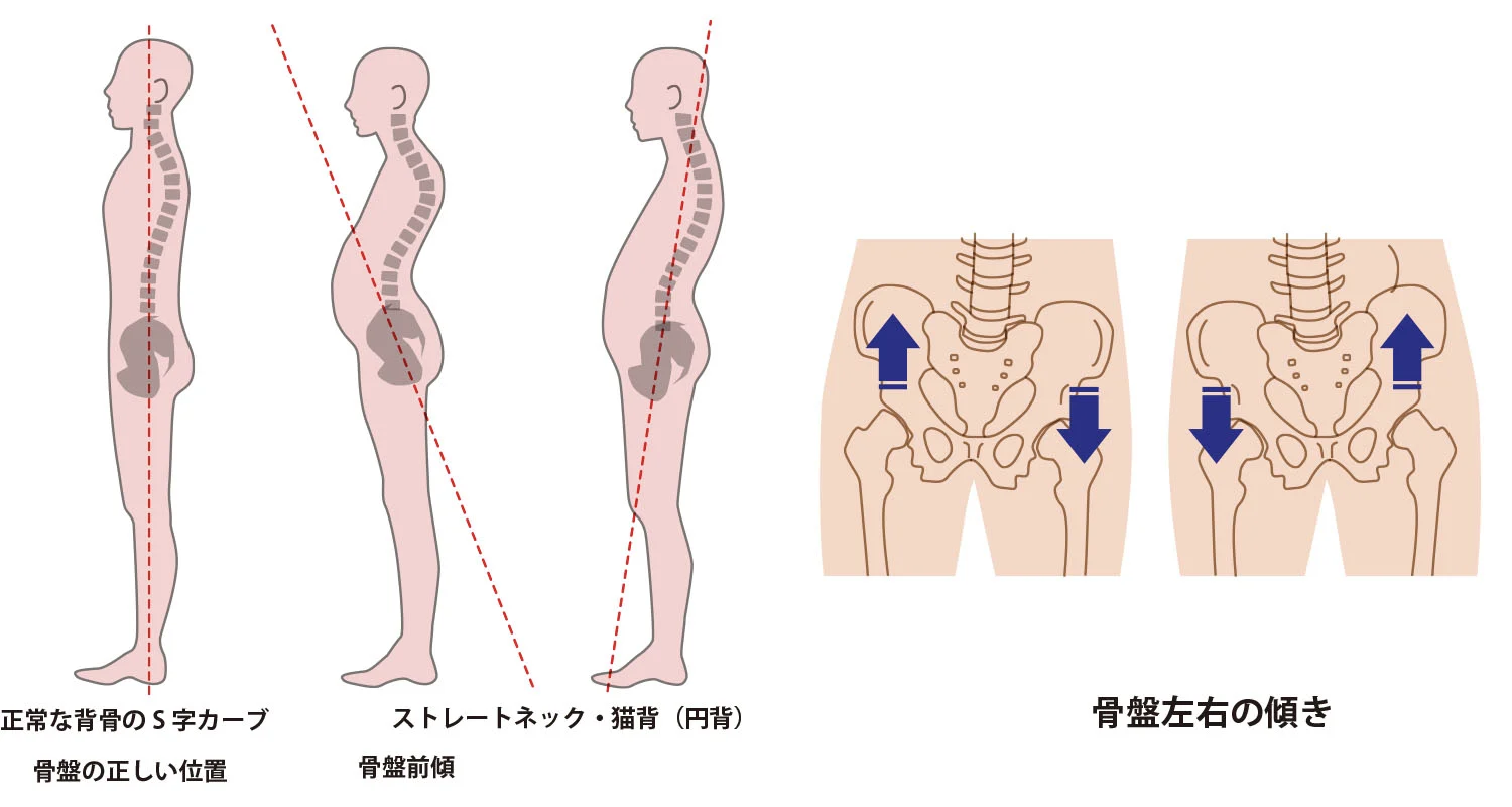 良い姿勢」になるためには、歪みのない骨盤と背骨（脊柱）